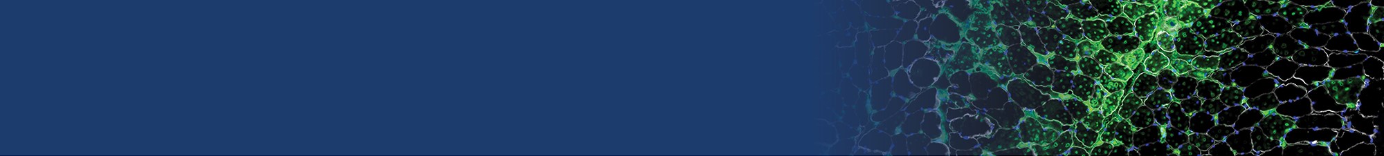 8th Annual UCI Neuromuscular Pathology Colloquium Banner
